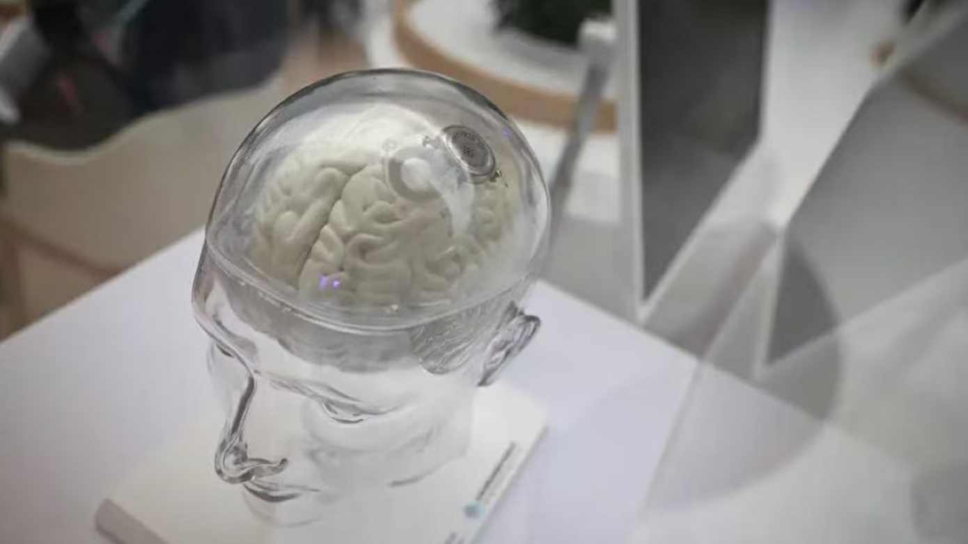  万亿级产业重塑：AI技术驱动下的大健康变革之路 健康养生